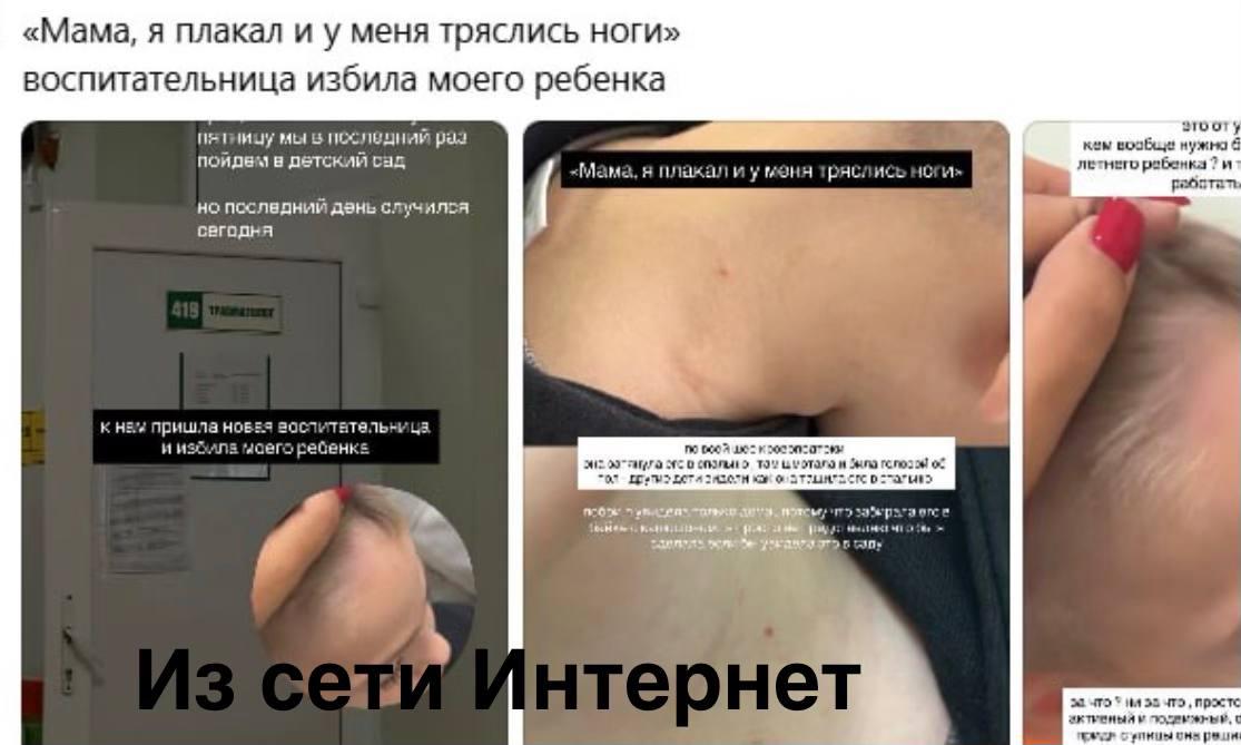 Un'educatrice di un asilo di Minsk accusata di aver picchiato un bambino