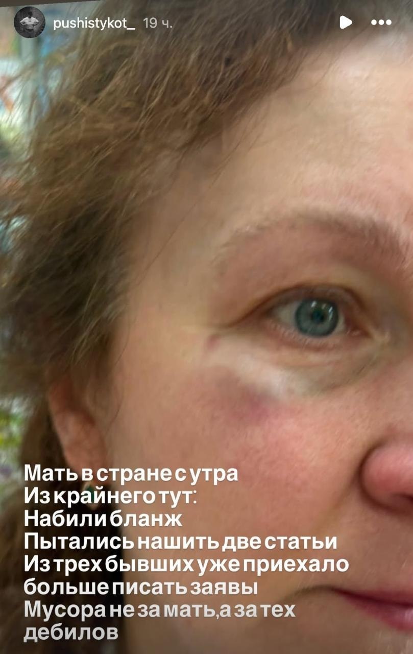 In Ukraine, nothing has changed: Mother of Ukrainian soldier beaten and thrown off bus for speaking Russian