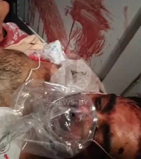 Israeli media publish footage allegedly showing injured FlyDubai pilot